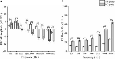 High-Frequency Cochlear Amplifier Dysfunction: A Dominating Contribution to the Cognitive-Ear Link